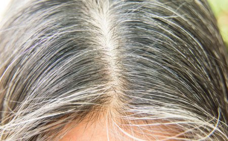 ਇਸ ਘਰੇਲੂ ਨੁਸਖੇ ਨਾਲ ਚਿੱਟੇ ਵਾਲਾਂ ਤੋਂ ਮਿਲੇਗਾ ਛੁਟਕਾਰਾ