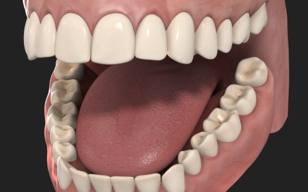 ਕੈਂਸਰ ਪੈਦਾ ਕਰਦੇ ਤੁਹਾਡੇ ਦੰਦ ਜੇ ਨਾ ਕਰੋ ਇਹ ਕੰਮ, ਜਾਣੋ ਕੀ ਹਨ ਕਾਰਨ ਤੇ ਇੰਝ ਕਰੋ ਬਚਾਅ