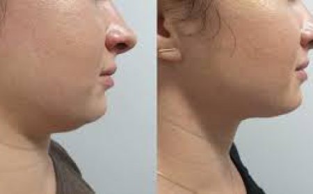 ਡਬਲ ਚਿਨ ਨਾਲ ਖੂਬਸੂਰਤੀ ਨੂੰ ਗ੍ਰਹਿਣ, ਤਾਂ ਵਰਤੋ ਇਹ ਉਪਾਅ