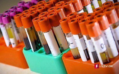 ਹੁਣ ਨਹੀਂ ਬੋਲ ਸਕੋਗੇ ਡਾਕਟਰ ਕੋਲ ਝੂਠ !